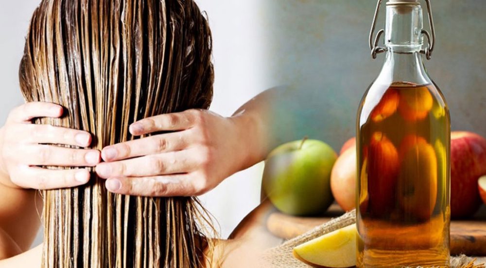 Giấm táo giúp kháng khuẩn, kiểm soát nấm da đầu.