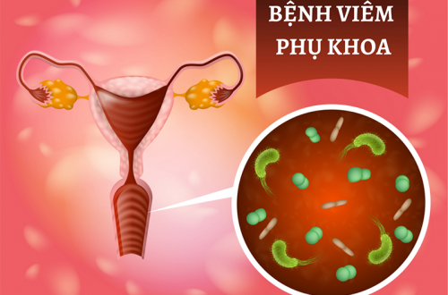 dung-dich-ve-sinh-phu-nu-tri-viem-1