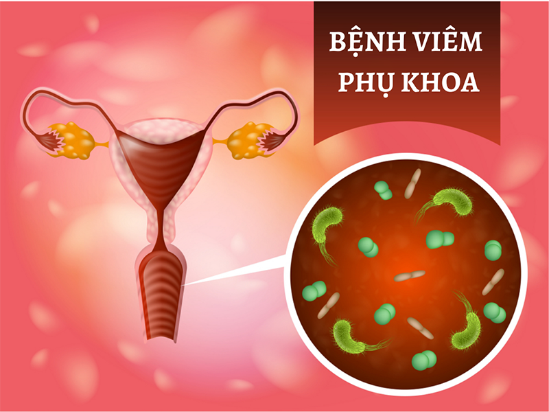 dung-dich-ve-sinh-phu-nu-tri-viem-1