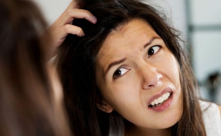 Mẹo hết ngứa da đầu hiệu quả tại nhà