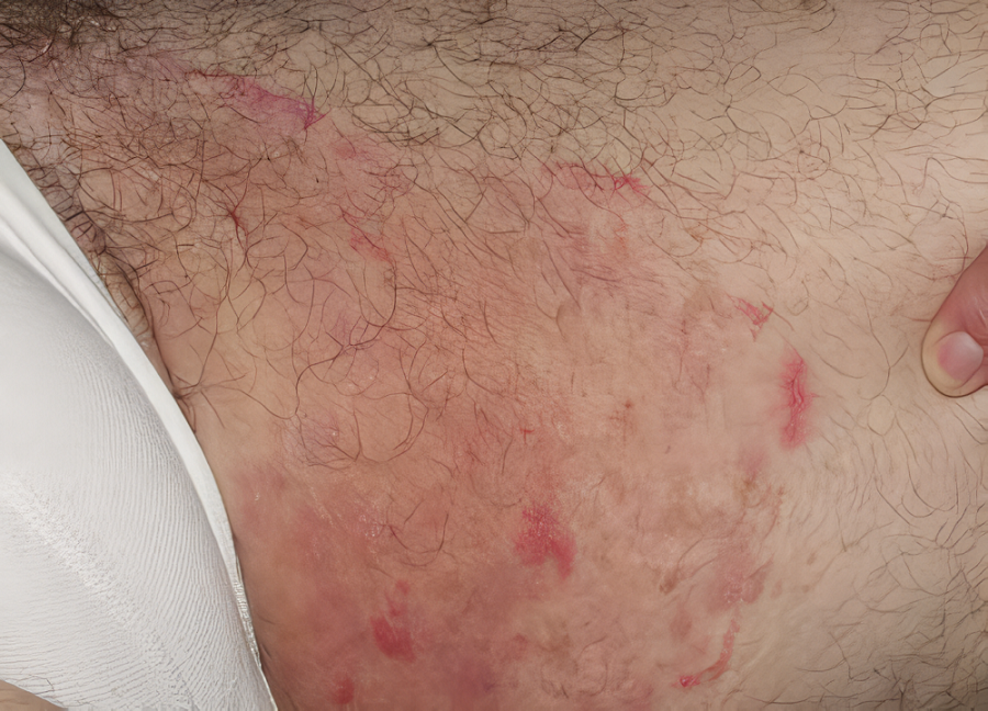 bi-ngua-va-noi-man-do-o-vung-kin-nu-2