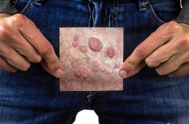 bi-ngua-vung-kin-o-nam-gioi-1