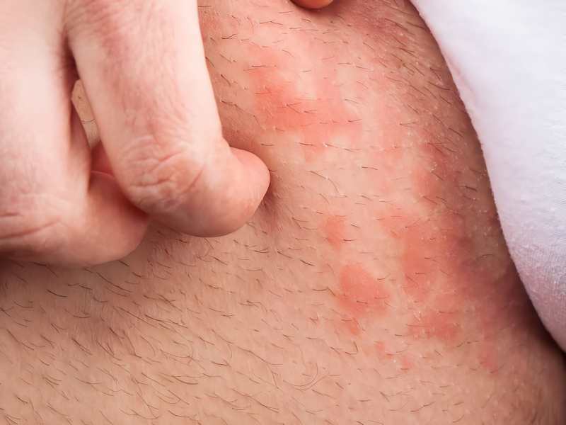 bi-ngua-vung-kin-o-nam-gioi-4