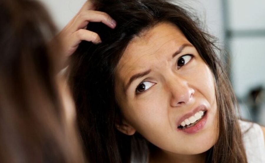 Mất cân bằng vi sinh, bã nhờn là nguyên nhân gây ra gàu