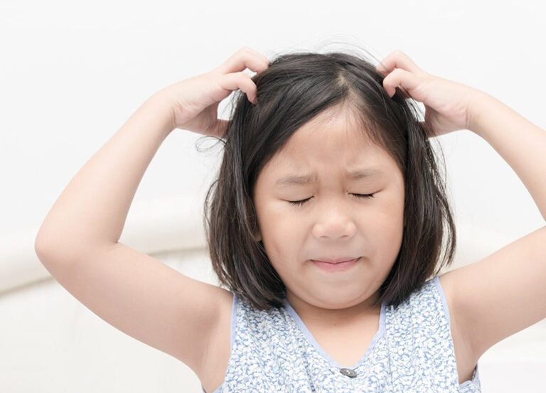 Nếu gàu dai dẳng kèm viêm da đầu, nên đến gặp bác sĩ để được khám và điều trị đúng mạch.