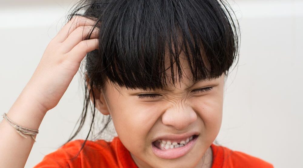 Trẻ em cũng có nguy cơ bị gàu như người lớn.