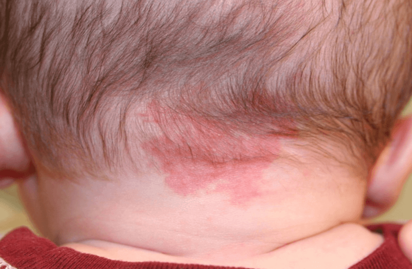 Mẹ nên đưa trẻ đi khám nếu xuất hiện các dấu hiệu bất thường.