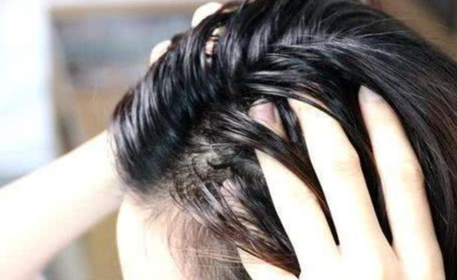 dầu gội cho da dầu và gàu là giải pháp thiết thực giúp làm sạch sâu