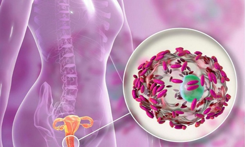 dung-dich-ve-sinh-tri-viem-ngua-1