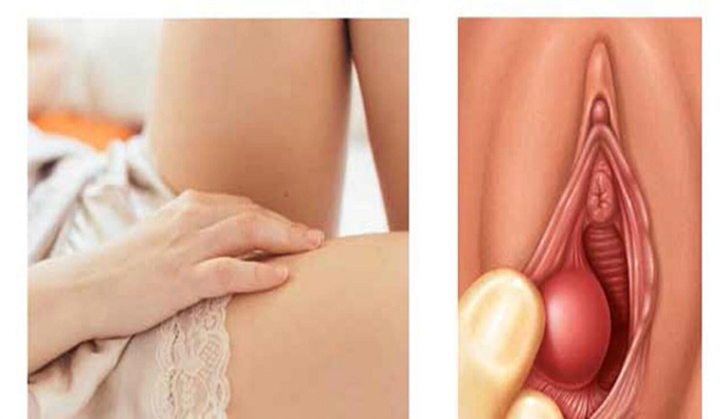 hay-bi-ngua-vung-kin-3