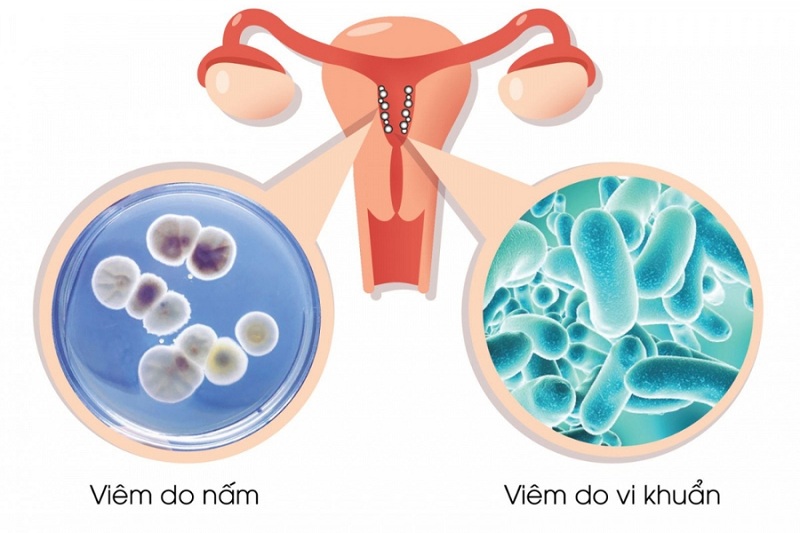 ngua-vung-kin-ve-dem-3