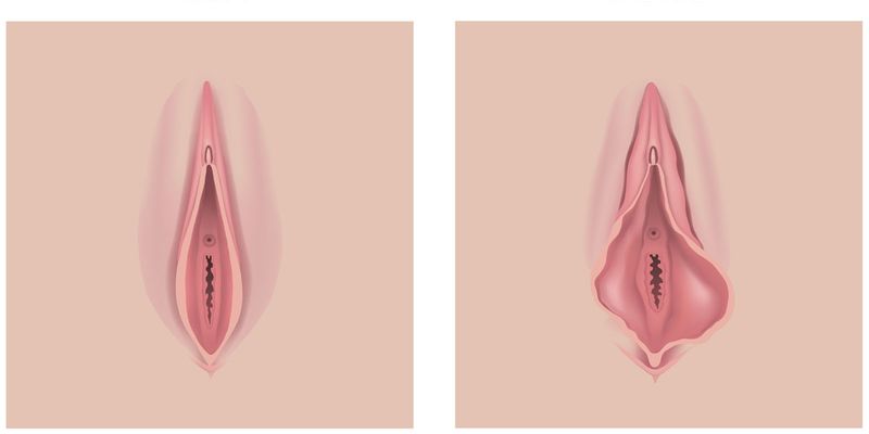 nuoc-rua-phu-khoa-lam-se-khit-vung-kin-2