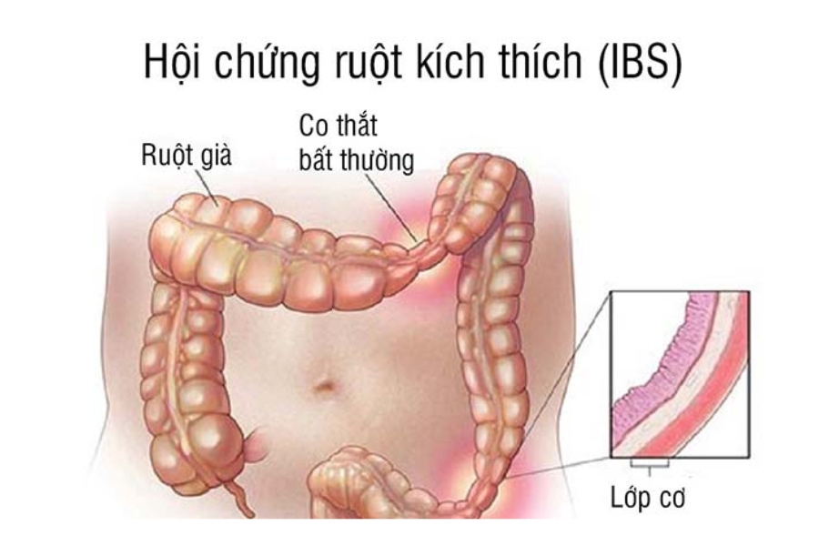tieu-chay-keo-dai-khong-ro-nguyen-nhan-3