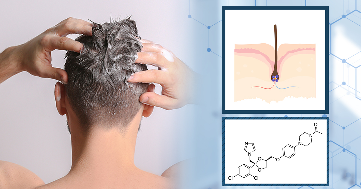 Ketoconazole là một hoạt chất kháng nấm phổ rộng giúp điều trị nấm da đầu.