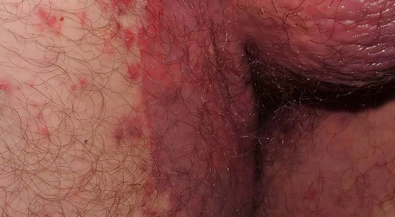 ngua-bo-phan-sinh-duc-nam-2