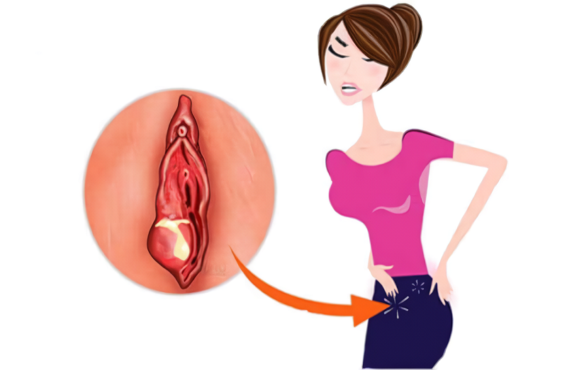 vung-kin-bi-ngua-ngay-kho-chiu-2