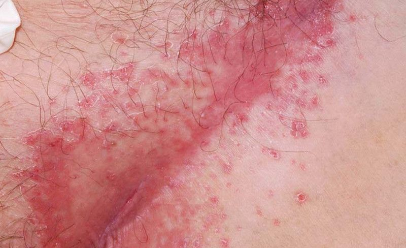 vung-kin-bi-noi-man-do-va-ngua-2