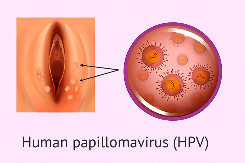vung-kin-noi-hat-ngua-1