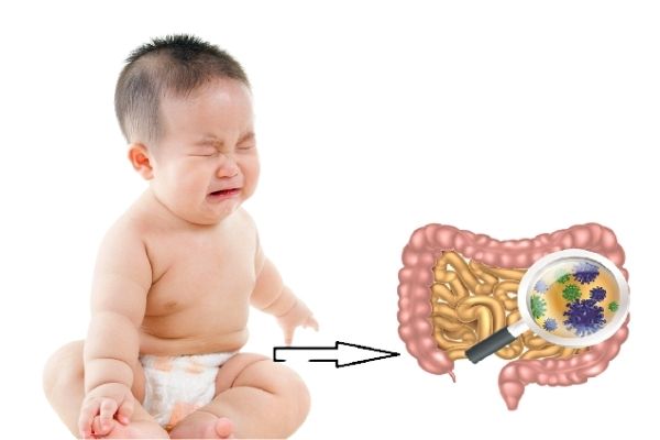 be-2-thang-tuoi-bi-tao-bon-4