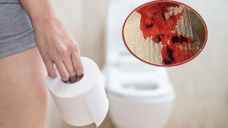 cach-chua-tao-bon-sau-sinh-2