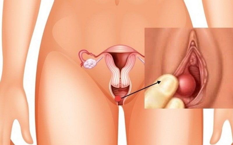 5-dau-hieu-nhan-biet-viem-nhiem-phu-khoa-4