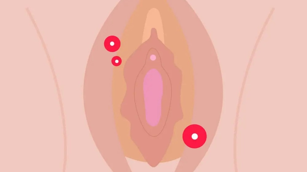 5-dau-hieu-nhan-biet-viem-nhiem-phu-khoa-6