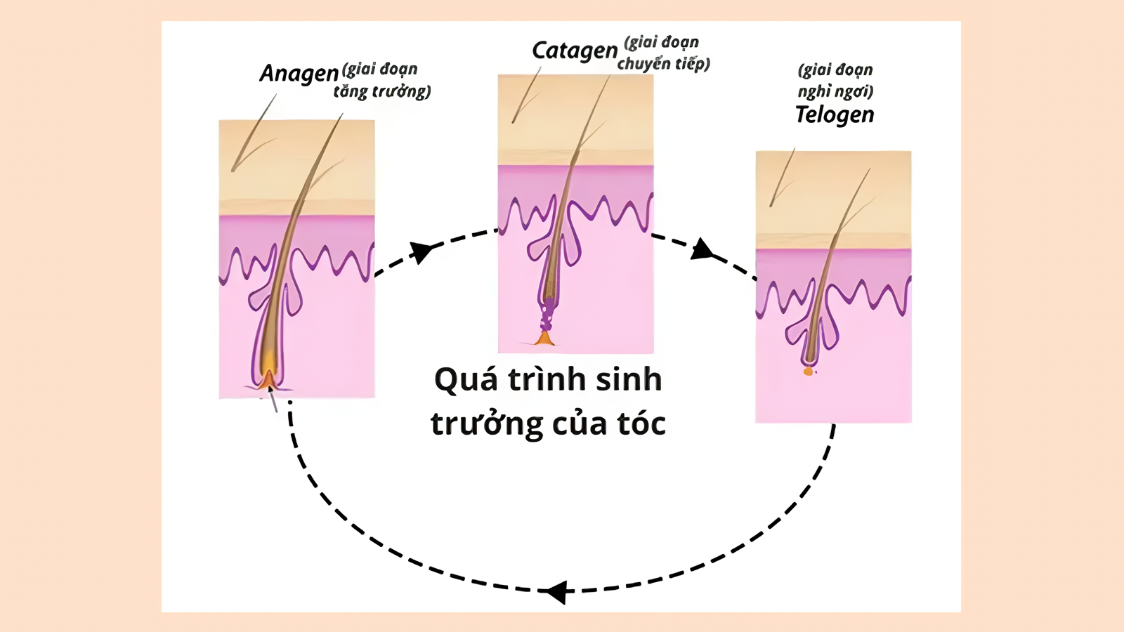 Quá trình sinh trưởng của tóc ở ba giai đoạn