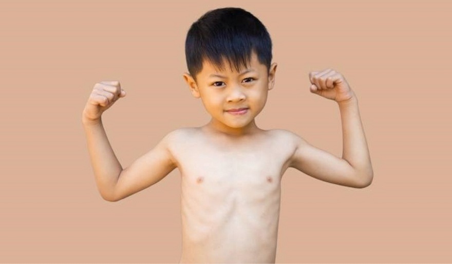 cach-phong-tranh-benh-suy-dinh-duong-thap-coi-1