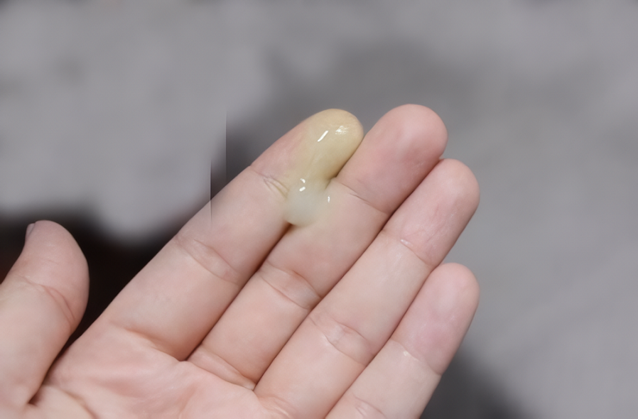 dau-hieu-viem-nhiem-vung-kin-2