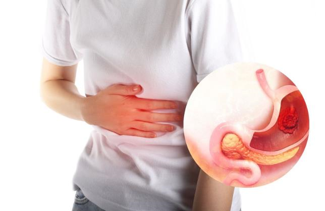 day-bung-kho-tieu-uong-gi-1