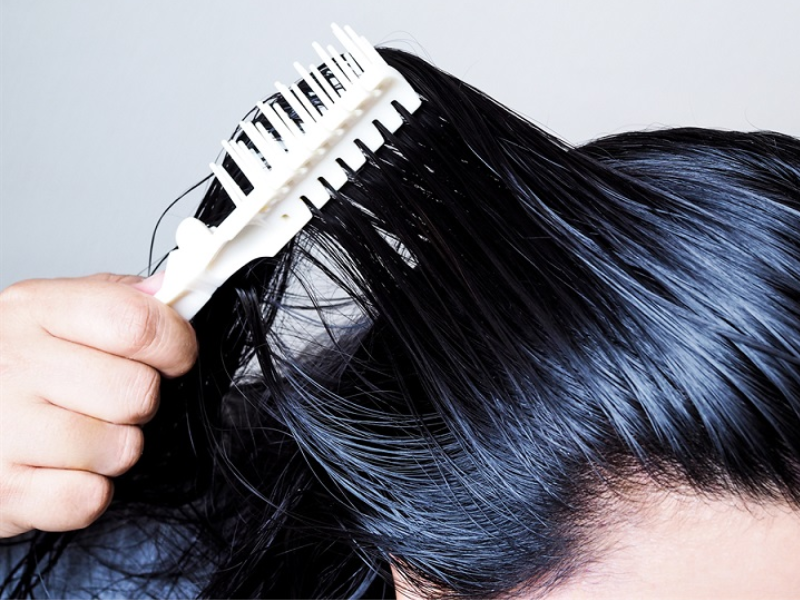 Nấm tóc gây rụng tóc thành mảng tròn, kèm ngứa và bong vảy dai dẳng.