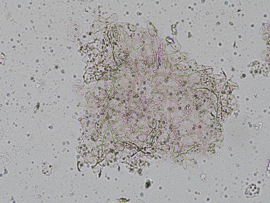 Khuẩn nấm Dermatophytes -nguyên nhân nấm da đầu