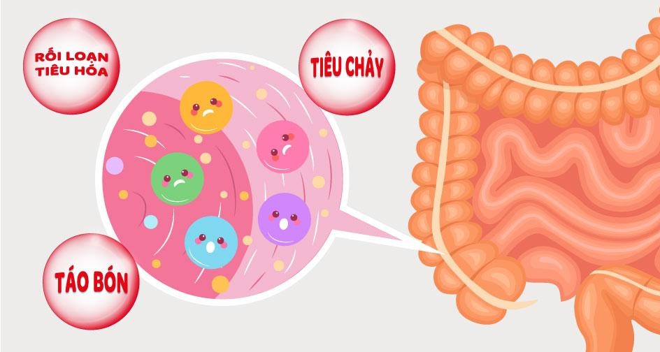 roi-loan-he-vi-sinh-duong-ruot-3