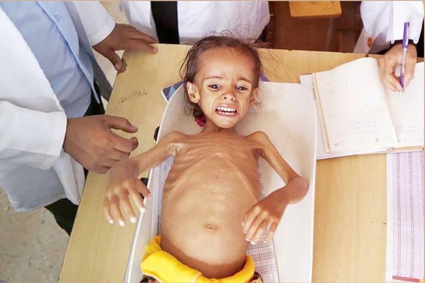 tre-suy-dinh-duong-thap-coi-nen-bo-sung-gi-1