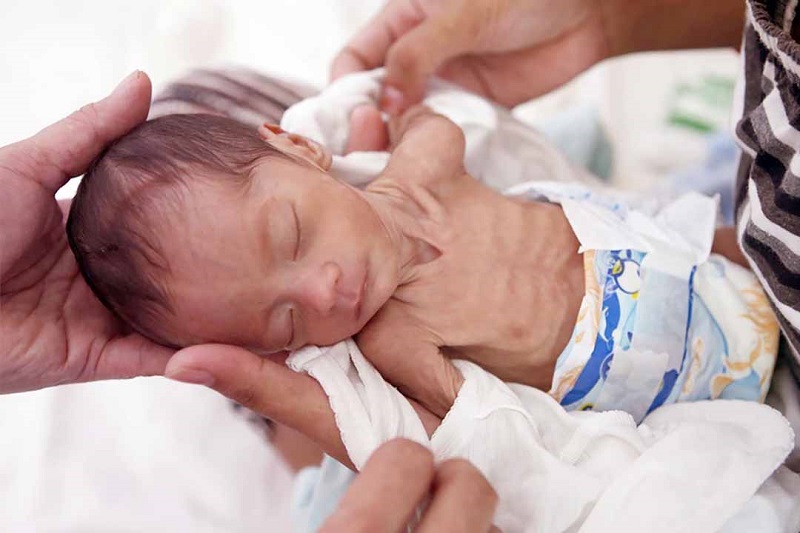 trieu-chung-suy-dinh-duong-o-tre-em-1