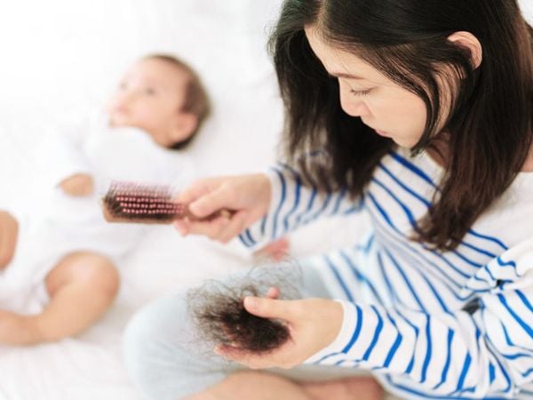 Tình trạng rụng tóc sau sinh khá phổ biến do xáo trộn nội tiết tố nữ, vậy đâu là cách chăm sóc tóc sau sinh