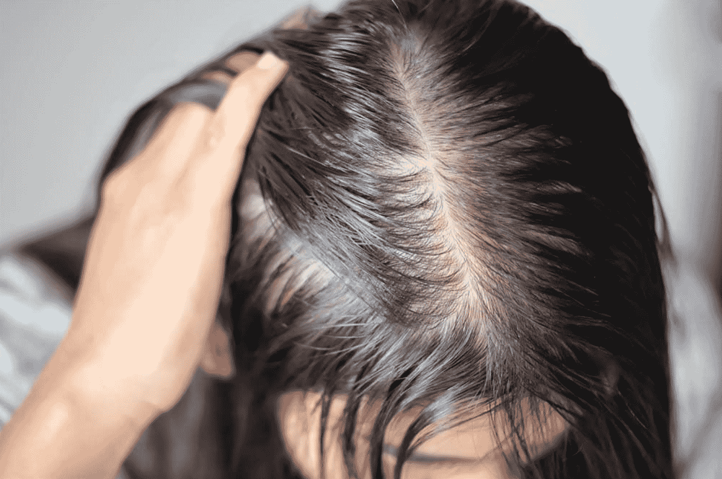 Rụng tóc khiến chị em lo lắng