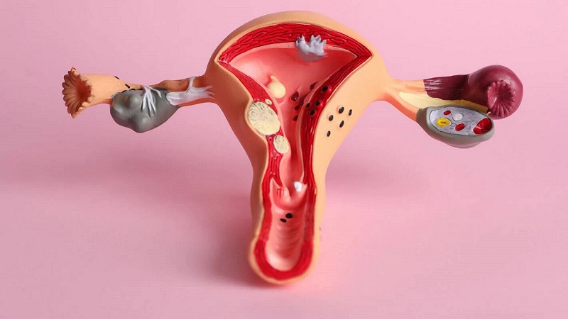 vung-kin-co-mui-hoi-kham-va-ngua-1