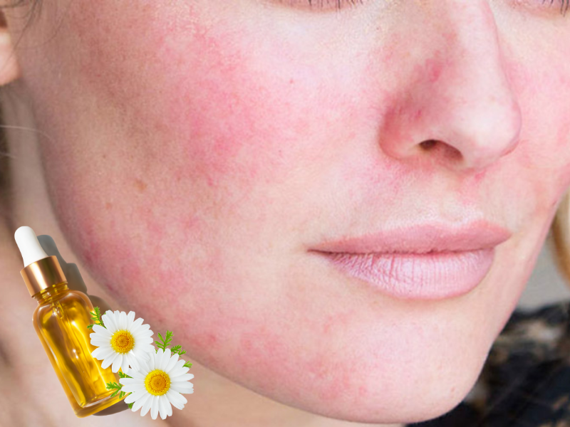 cuc-la-ma-trong-my-pham-2