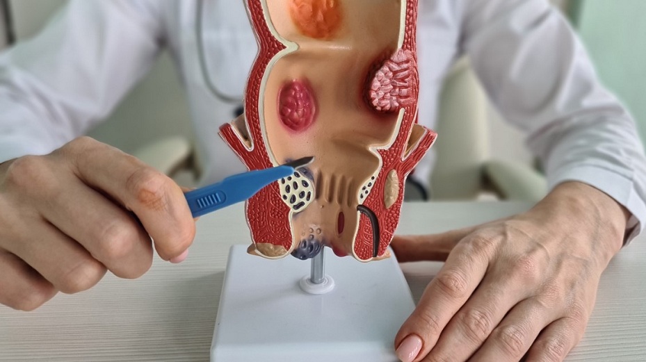 dau-bung-tao-bon-o-me-bau-2