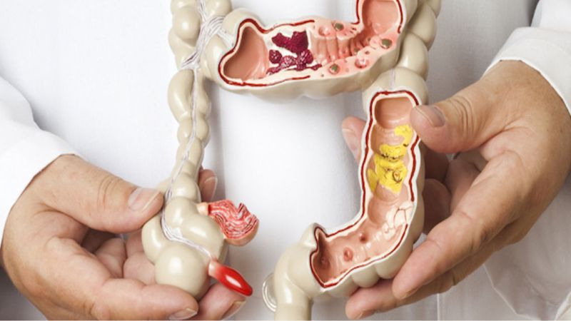 nguyen-nhan-gay-tao-bon-o-nguoi-cao-tuoi-1