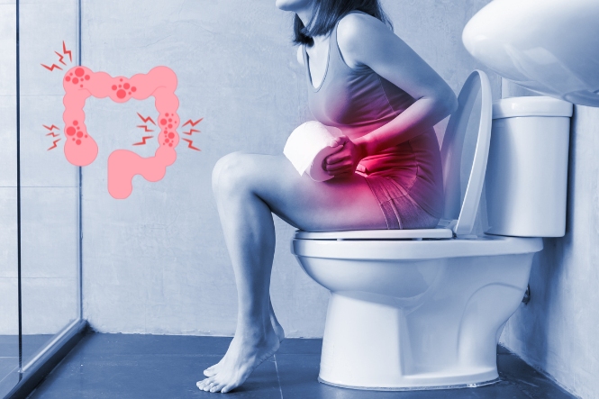 nguyen-nhan-gay-tao-bon-o-nguoi-lon-3