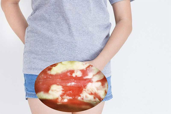 thuoc-tri-mui-hoi-vung-kin-3