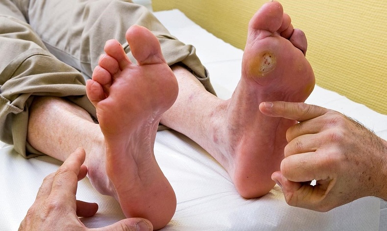 benh-tieu-duong-co-nguy-hiem-khong-3