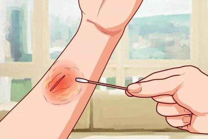 cac-trieu-chung-cua-benh-tieu-duong-3