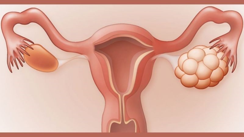 chu-ky-kinh-nguyet-khong-deu-2