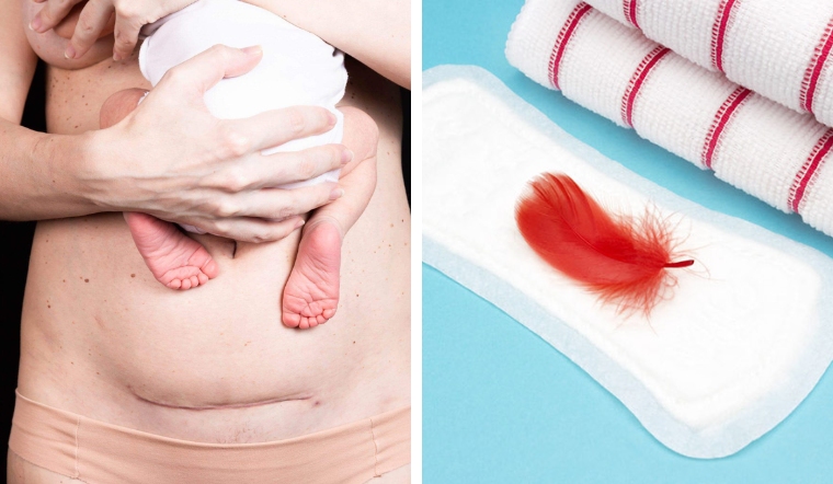 sau-sinh-kinh-nguyet-khong-deu-1