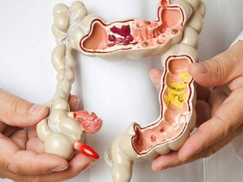 dau-hieu-dau-bao-tu-3