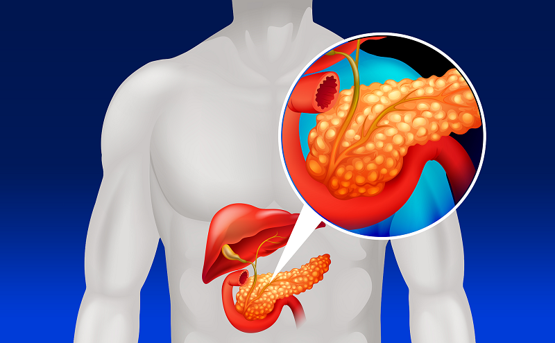 nguyen-nhan-gay-benh-tieu-duong-1