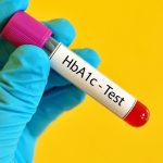 xet-nghiem-hba1c-1
